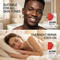 Invisible Hydrocolloid Acne Patches — 36-Piece Set