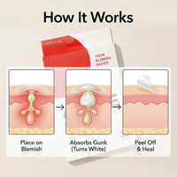 Invisible Hydrocolloid Acne Patches — 36-Piece Set
